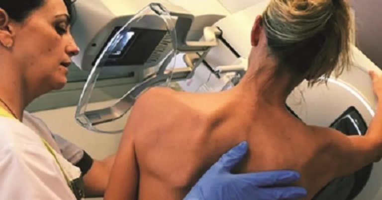 Mamografia: 7 mitos e verdades sobre o exame