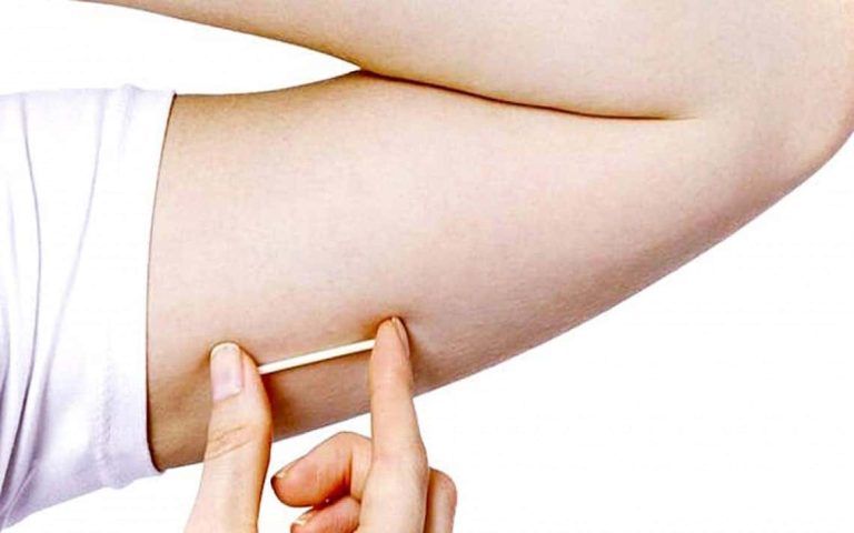 Implantes Hormonais: Entenda o que são e para que servem.