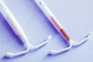DIU Hormonal: Tudo o que você precisa saber antes de escolher o seu método contraceptivo. - Dr. Carlos Moraes. Ginecologista e Obstetra - Morumbi - Osasco
